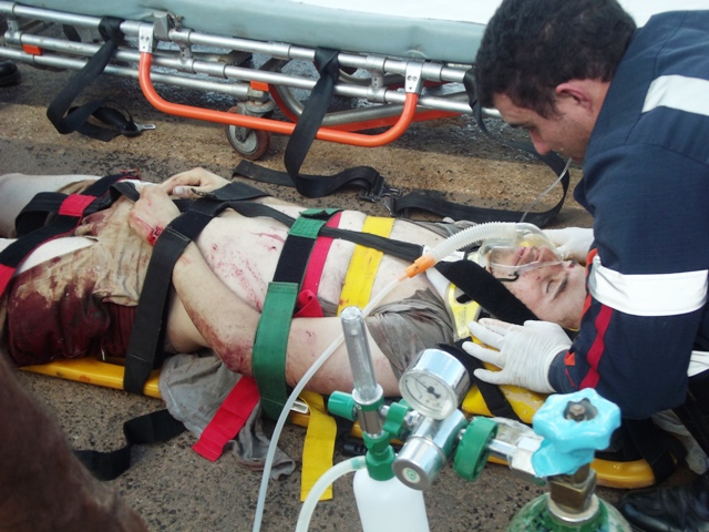 A vítima teve grave fatura na parte superior da perna