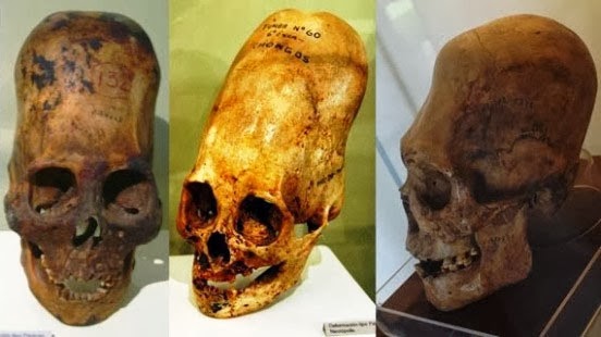 cranios_alongados_02