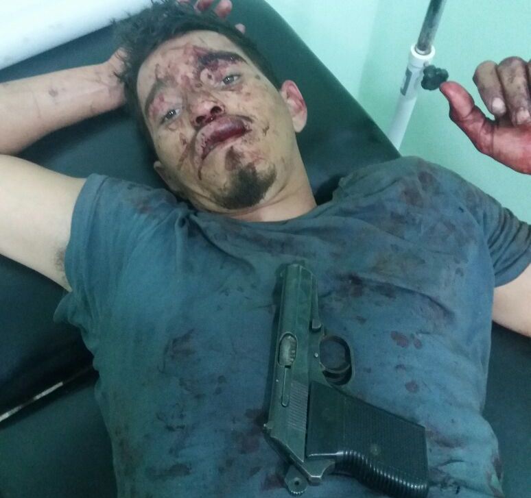 O ladrão preso, depois de ferido com um tiro na perna.